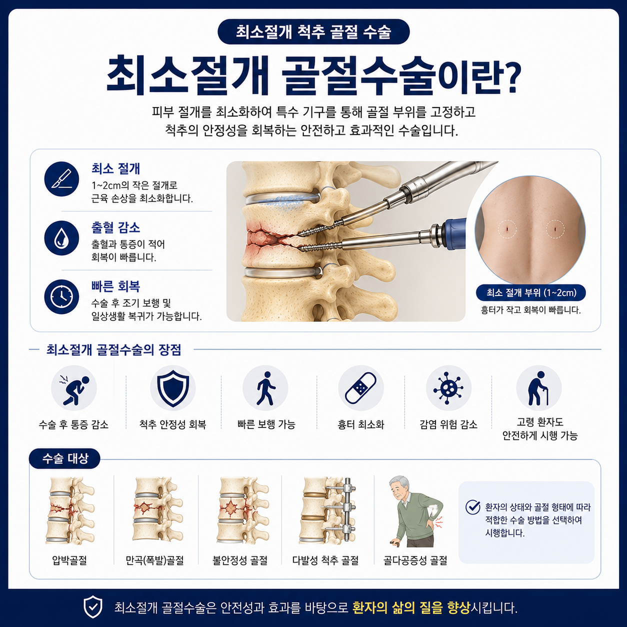 최소절개 골절수술.png