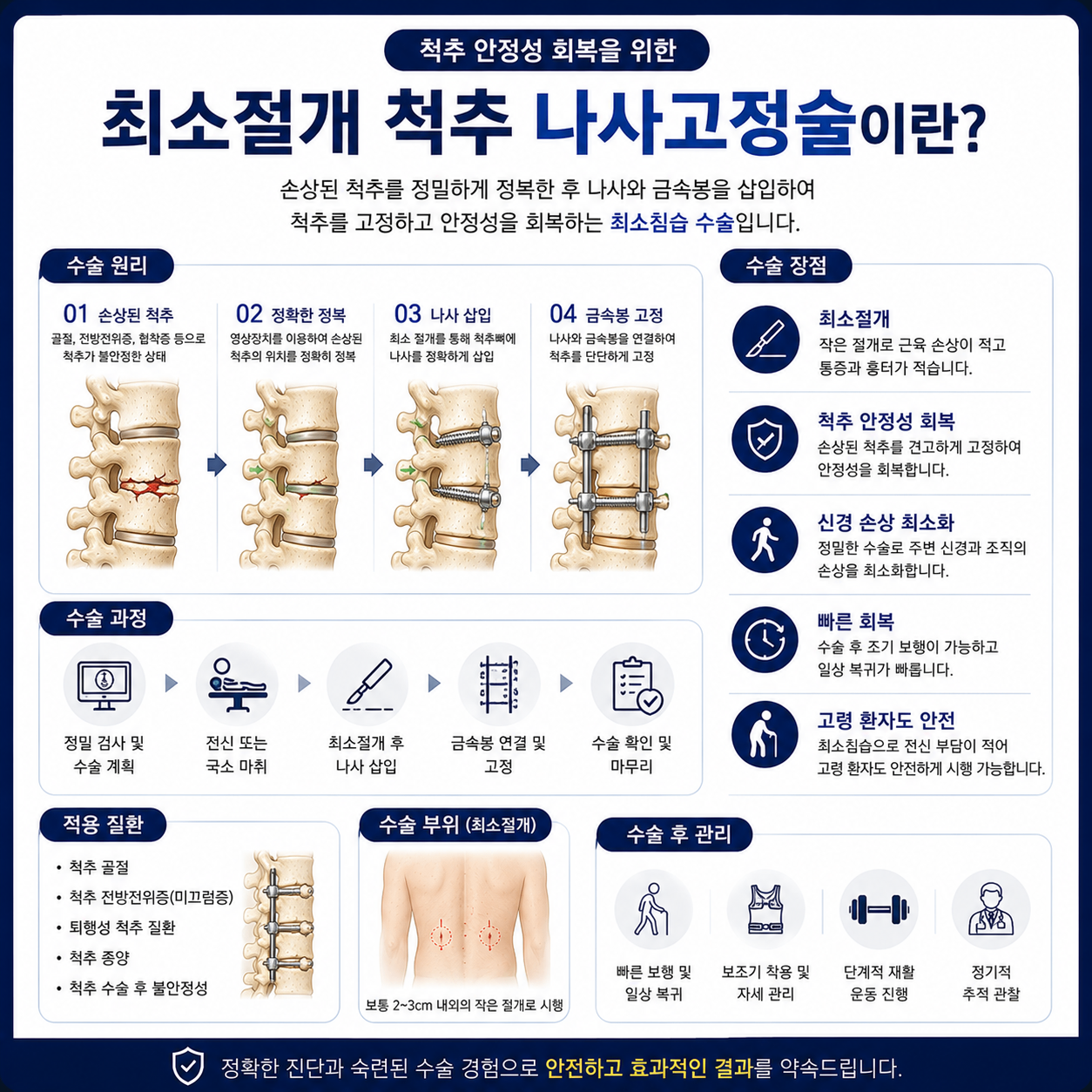 나사고정술.png