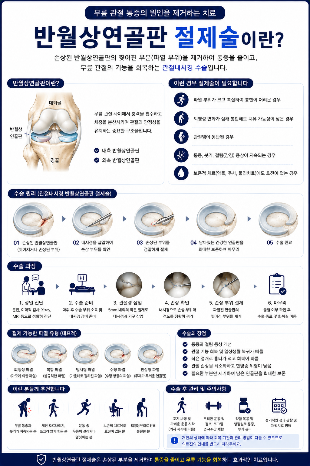 반월상연골판 절제술.png