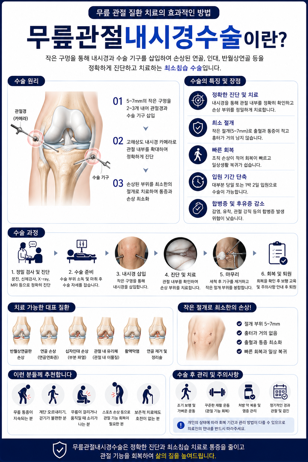 무릎관절 내시경수술.png